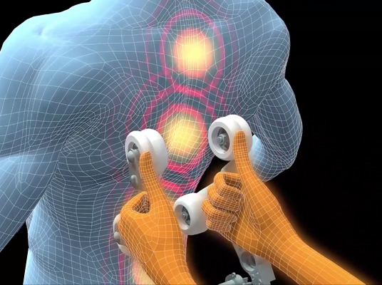 contractures